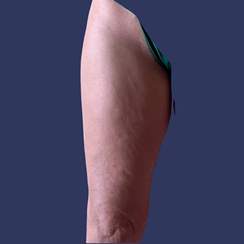 Body Roll - v1 -01