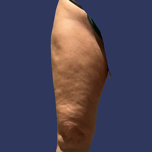 Body Roll - v1 -02