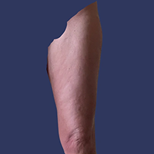 Body Roll - v2 -01