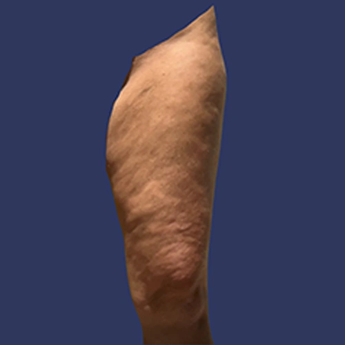 Body Roll - v2 -02
