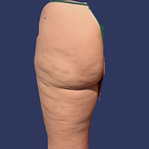 Body Roll - v3 -01