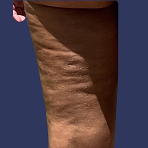 Body Roll - v4 -02