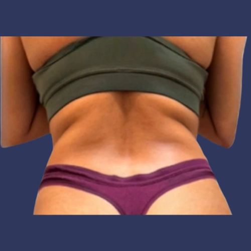 Body Roll - v6 -01