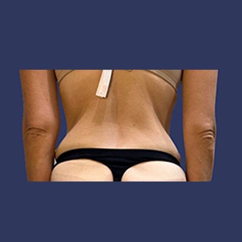 Body contour - 04-v1