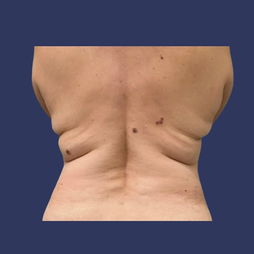 Body contour - 07-v1