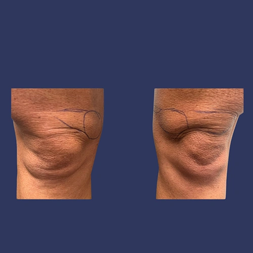 Body contour - 08-v1