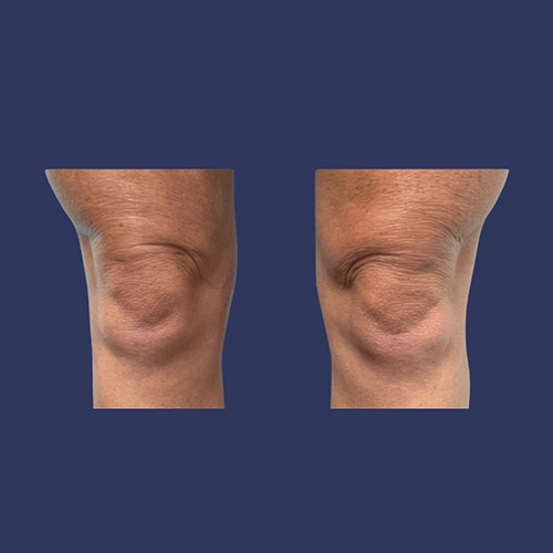 Body contour - 08-v2