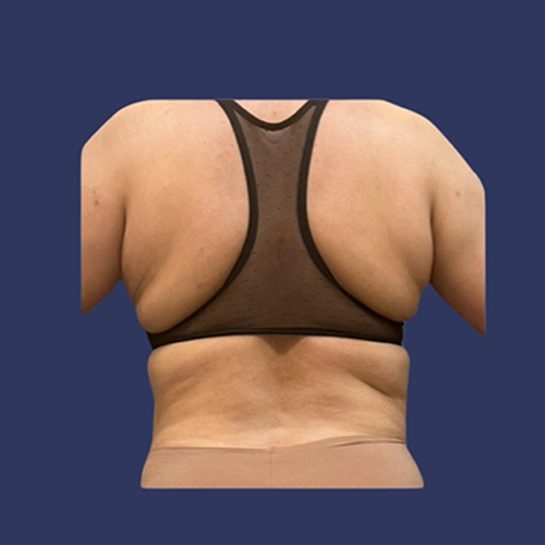 Body contour - 09-v1
