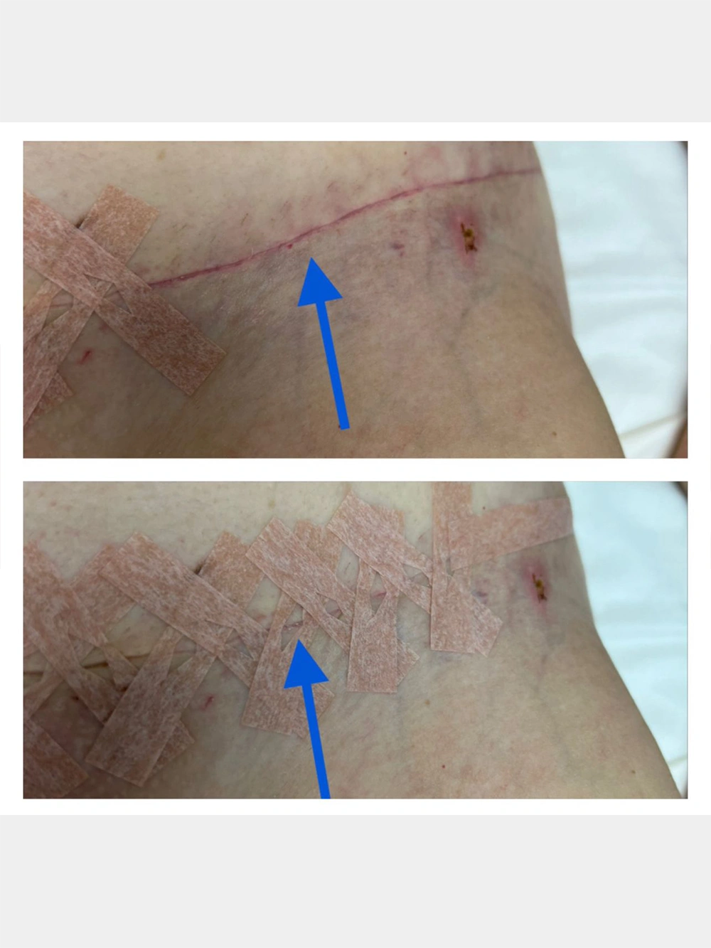04 - Without Paola FONGARO’s tape the first picture Below picture right after the tape