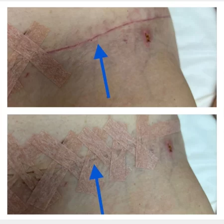 04 - Without Paola FONGARO’s tape the first picture Below picture right after the tape